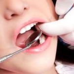 Hướng Dẫn về Bệnh Nha Chu