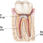 Răng chữa nội nha là răng chết như vậy có bền vững và giữ được lâu không? 