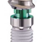 Có bao nhiêu hệ thống implant? 