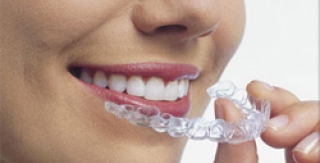 Phương pháp chỉnh hình răng mới Invisalign teen 