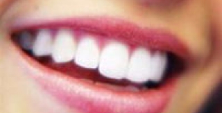 Bị tụt lợi, chữa được không? 