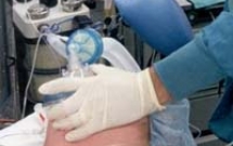 CÓ CẦN GÂY MÊ KHI ĐẶT IMPLANT ?