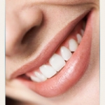 Điều trị cấy ghép răng mất bao lâu? 