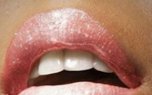 Điều trị răng sứ thẩm mỹ tại AVA mất bao lâu?