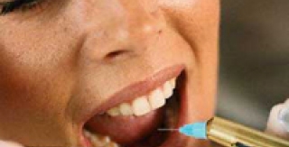 Lời khuyên của BS RHM đối với bệnh nhân nhổ răng