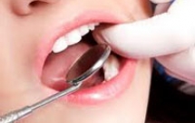 Hướng Dẫn về Bệnh Nha Chu