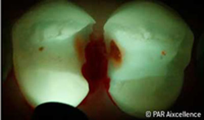 facelight-abb-6
