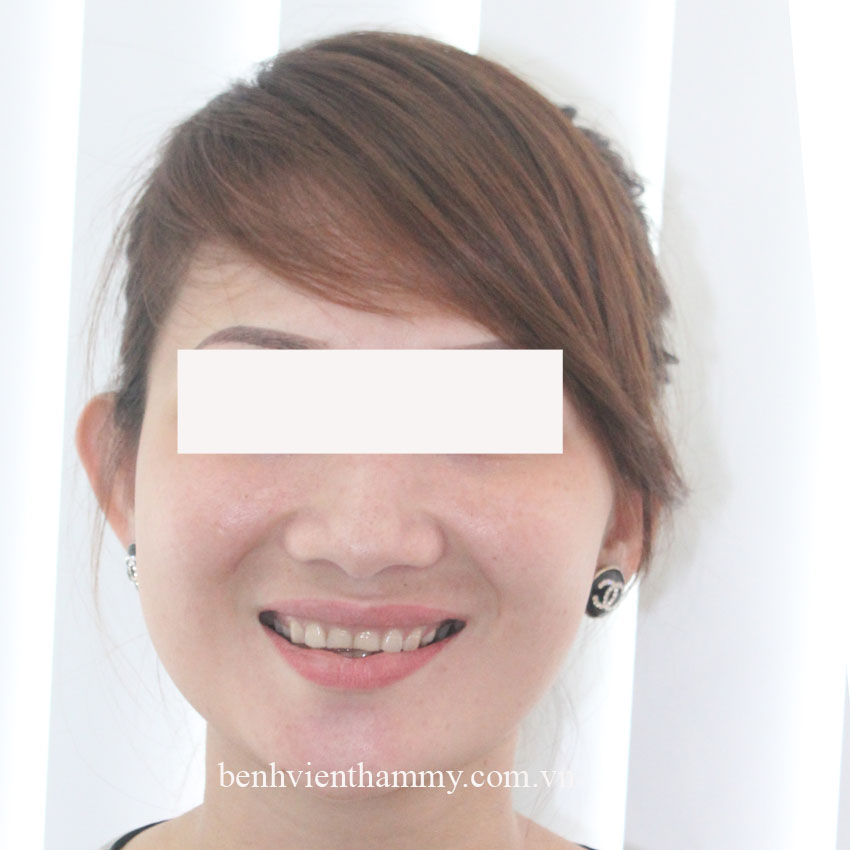 tao nu cuoi xinh 2